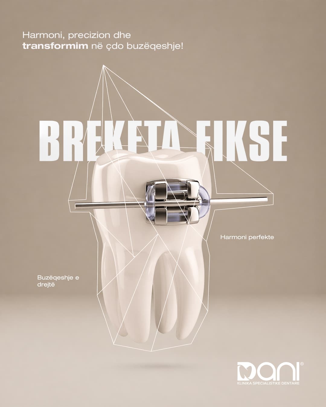 Breketa fikse