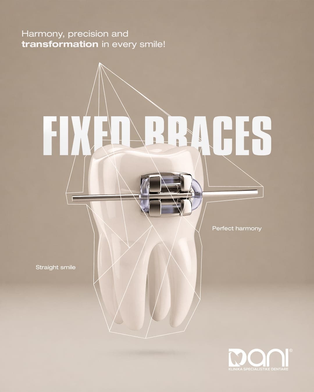 Fixed Braces