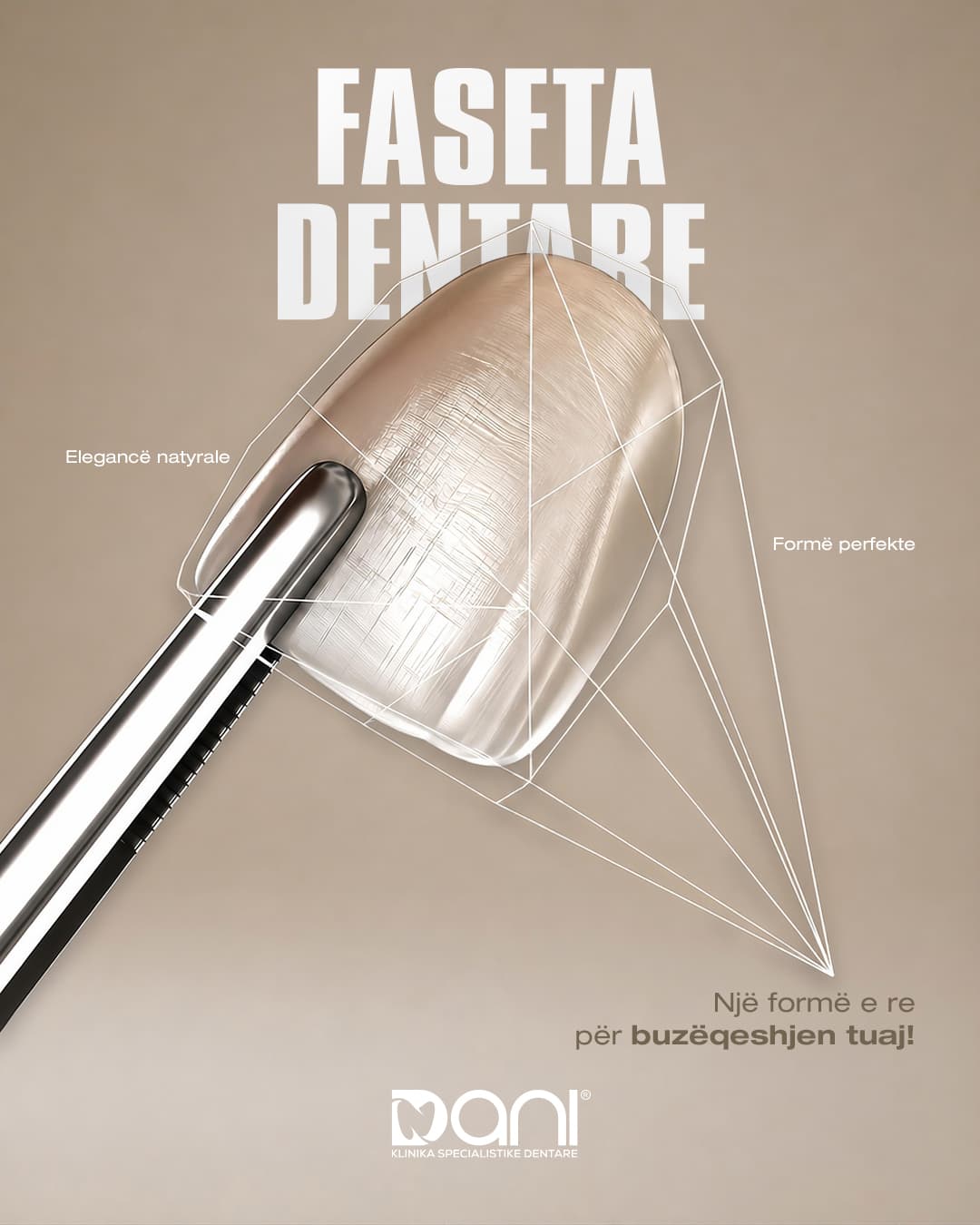 Faseta Dentare