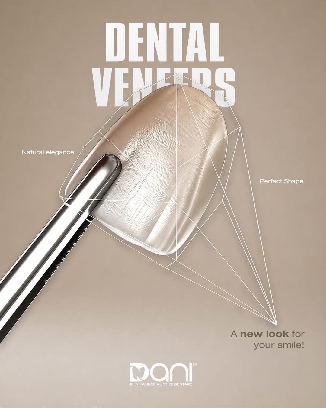 Dental Veneers