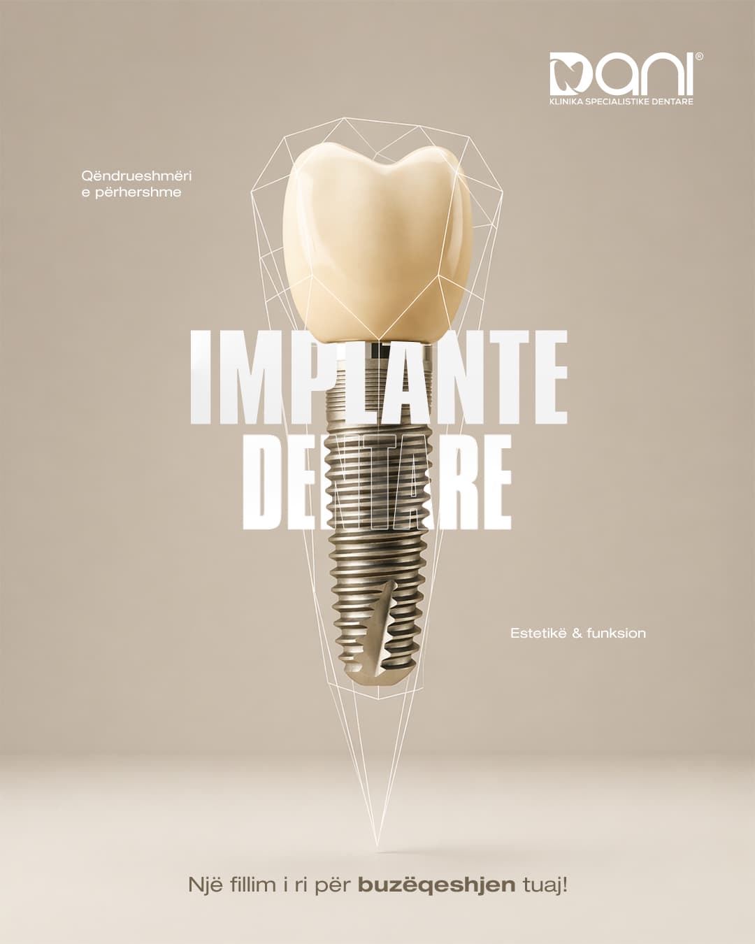 Implante Dentare